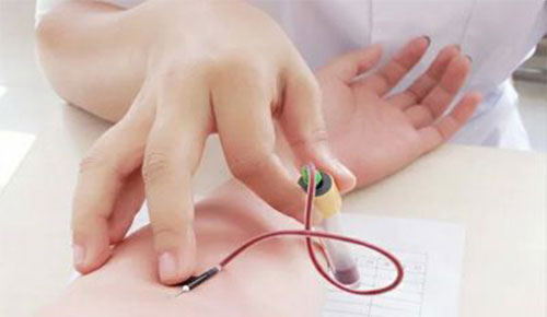 ת��ø����ֵ ת��ø�ߵ���ʳ����